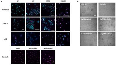 Sunitinib and Imatinib Display Differential Cardiotoxicity in Adult Rat Cardiac Fibroblasts That Involves a Role for Calcium/Calmodulin Dependent Protein Kinase II